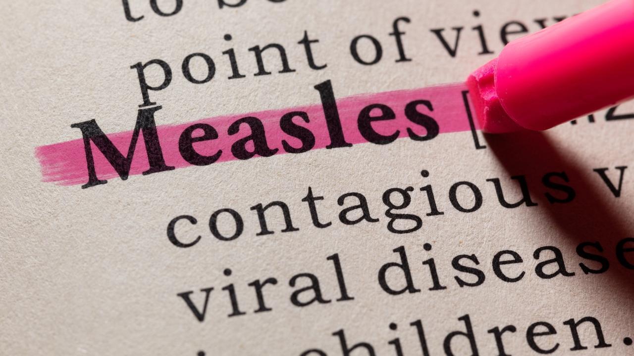 Potential Measles Exposures Spotted at South Calgary Hotel and Eateries