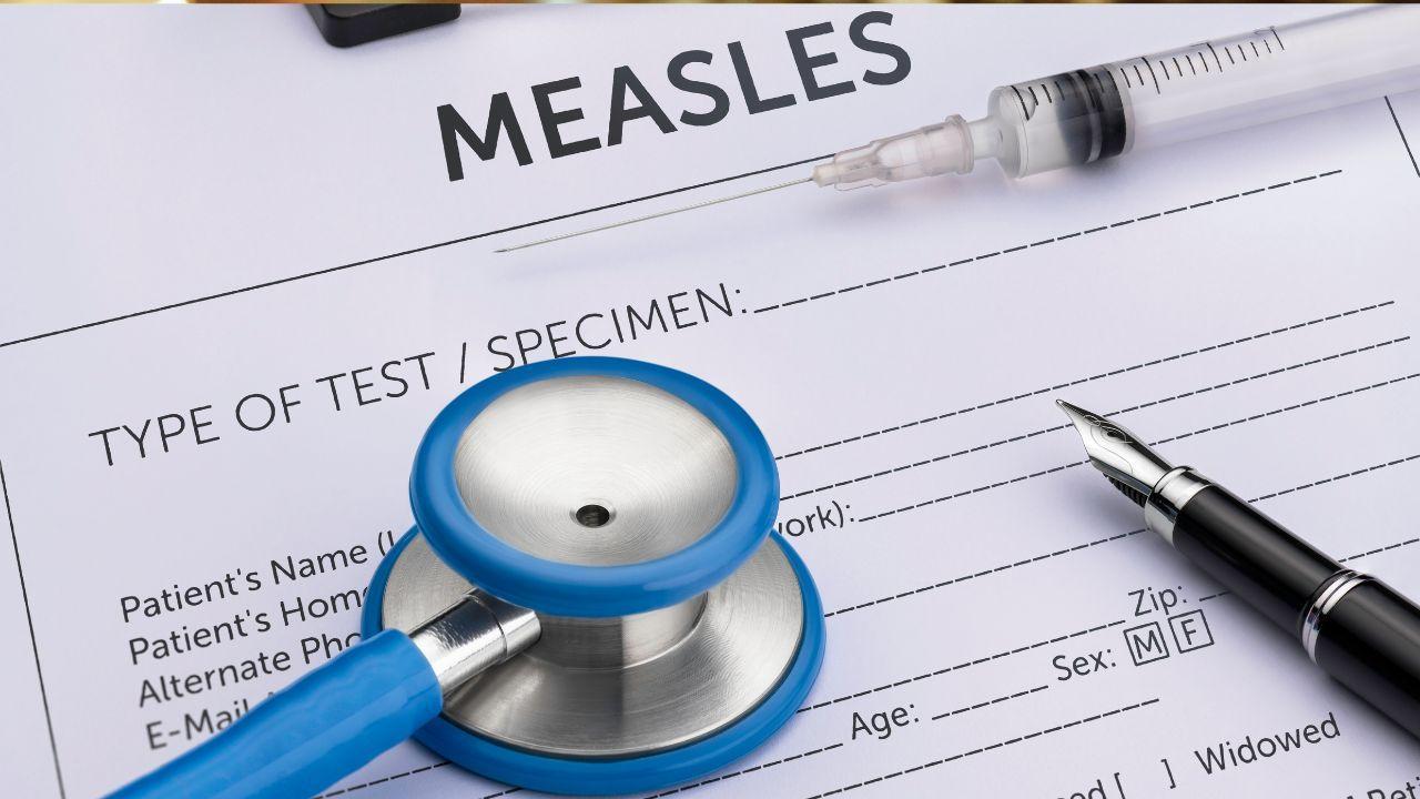 Alberta Measles Outbreak Alarms Edmonton Health Experts