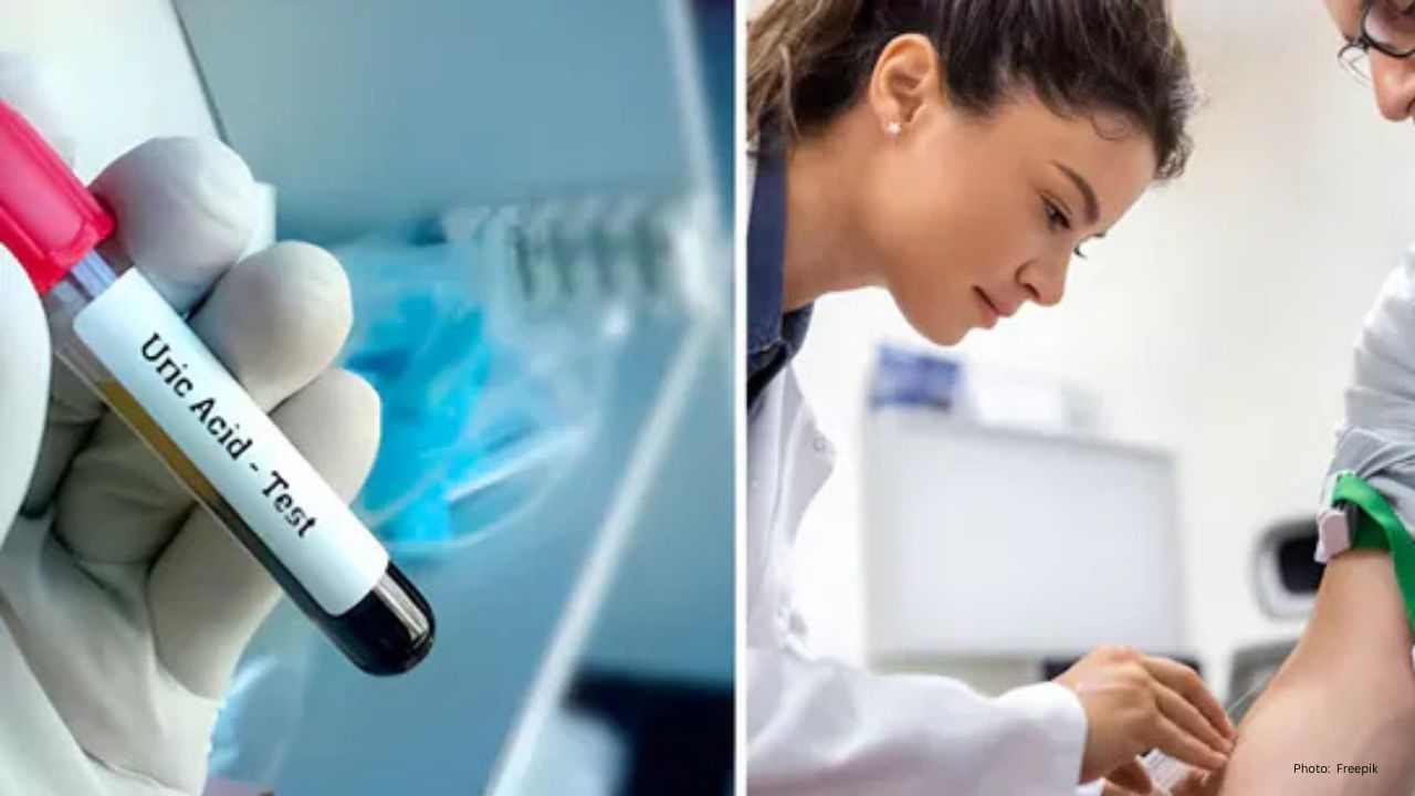 Uric Acid on the Rise? Five Health Conditions That Could Be Responsible