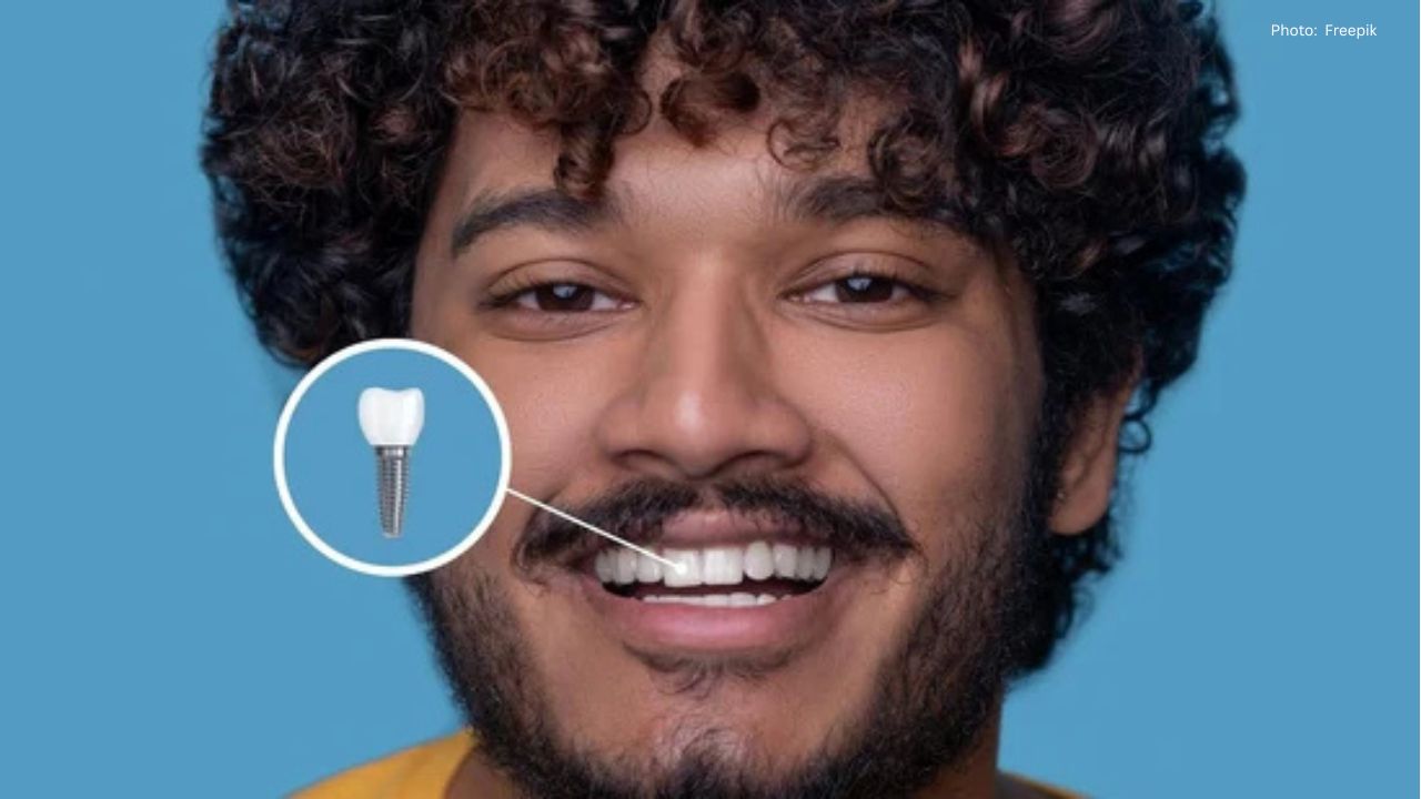 Mumbai Surgeon Discusses the Longevity of Dental Implants