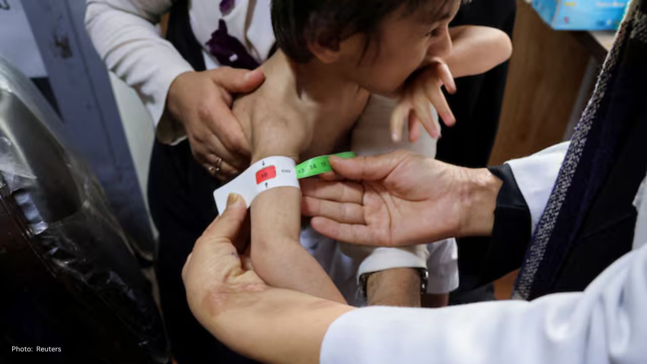 UN Alerts to Severe Hunger Crisis in Afghanistan as Aid Funds Dwindle