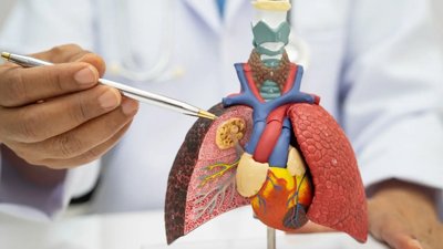 Experts Urge Radon Testing and Home Mitigation to Cut Lung Cancer Risk